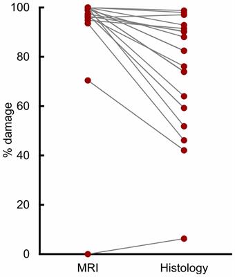 MRI Overestimates Excitotoxic Amygdala Lesion Damage in Rhesus Monkeys